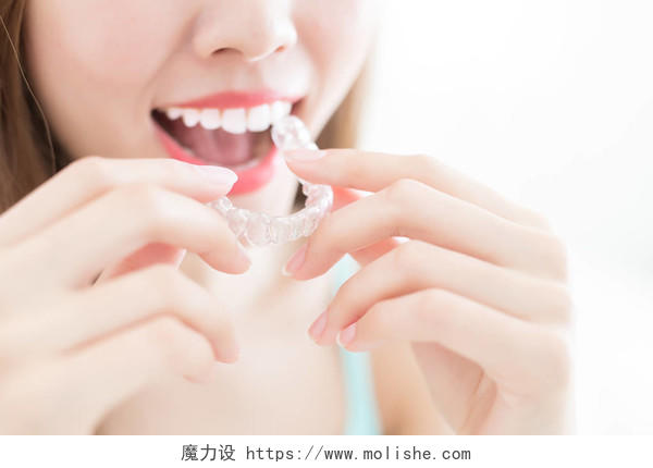 正在戴隐形牙套微笑的女人牙齿矫正修复口腔牙齿口腔牙齿